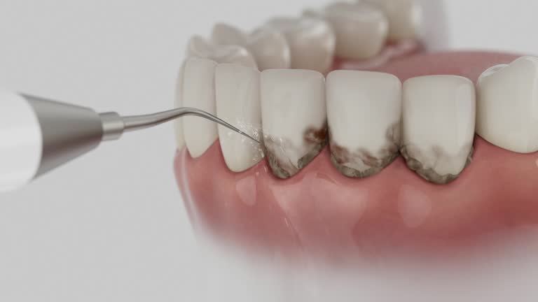 Reliable Dental Implants contractor in Mogadore, OH by Smile Center Dentistry